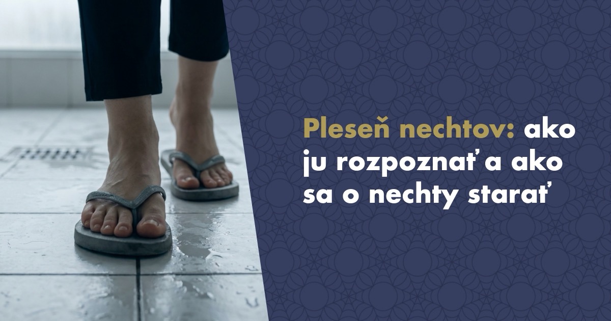 Pleseň nechtov (onychomykóza): ako ju rozpoznať, liečiť a starať sa o nechty