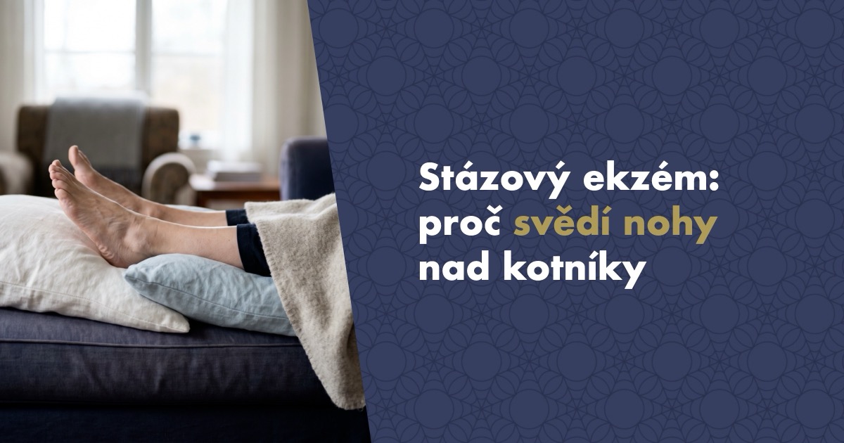Stázový ekzém: proč svědí nohy nad kotníky a co skutečně pomáhá